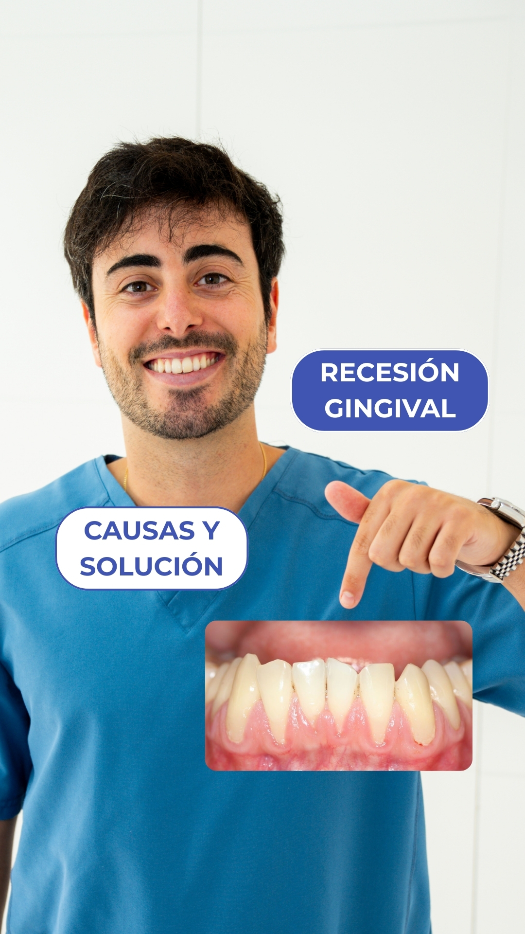 Recesion-gingival